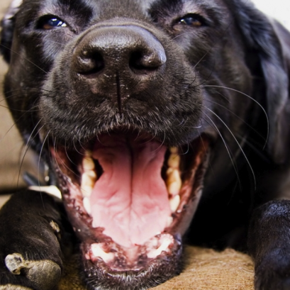 ขูดหินปูน (Dental Scaling Package)